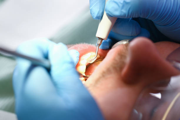 Best Walk-In Emergency Dental Services in Gothenburg, NE
