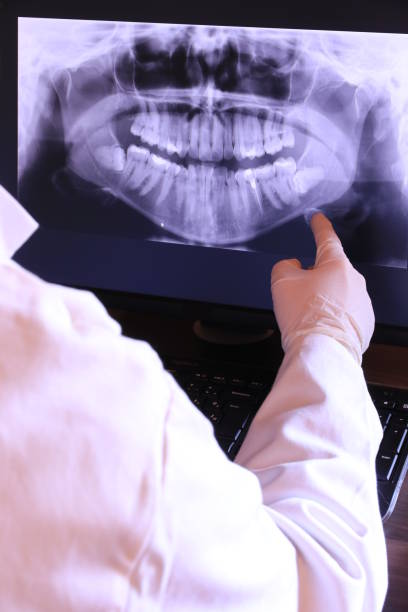 Best Emergency Wisdom Tooth Extraction in Gothenburg, NE